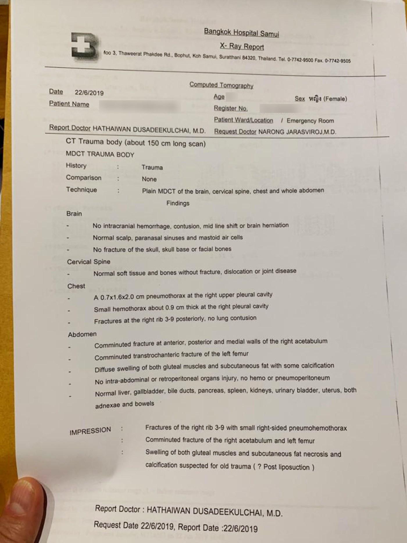 Результат рентгеновского обследования на английском